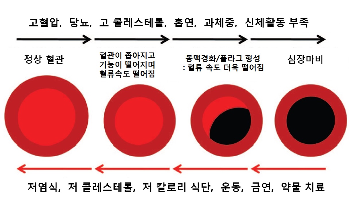 발기부전, 심장 건강의 적신호