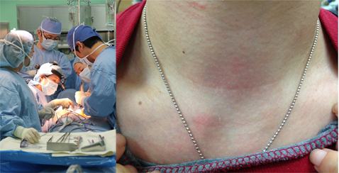 동남권원자력의학원 갑상선암 수술 1천례 돌파 