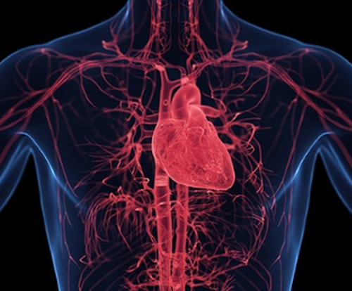 뇌혈관 정밀 프로그램