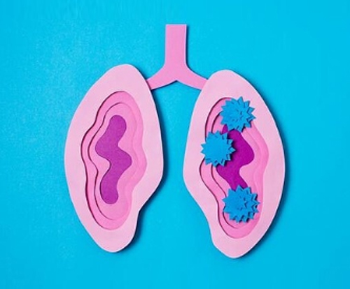 뇌혈관 정밀 프로그램