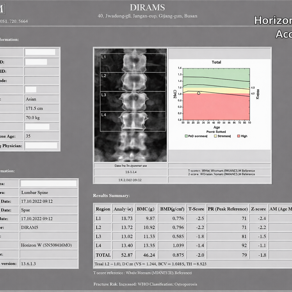 Bone Mineral Densitometry : BMD 사진