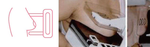 유방 영상 촬영 사진