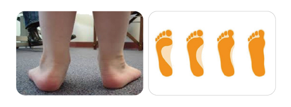 자세 이상 클리닉 이미지